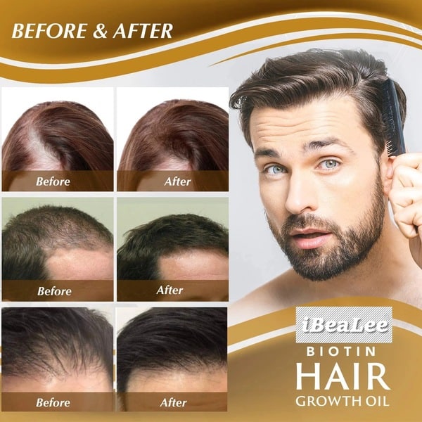iBeaLee Hair Care Solution Strong Hair Nutrition Anti-falling Moisturizing Hair Root Thick Scalp Massage Nutrition - Image 5