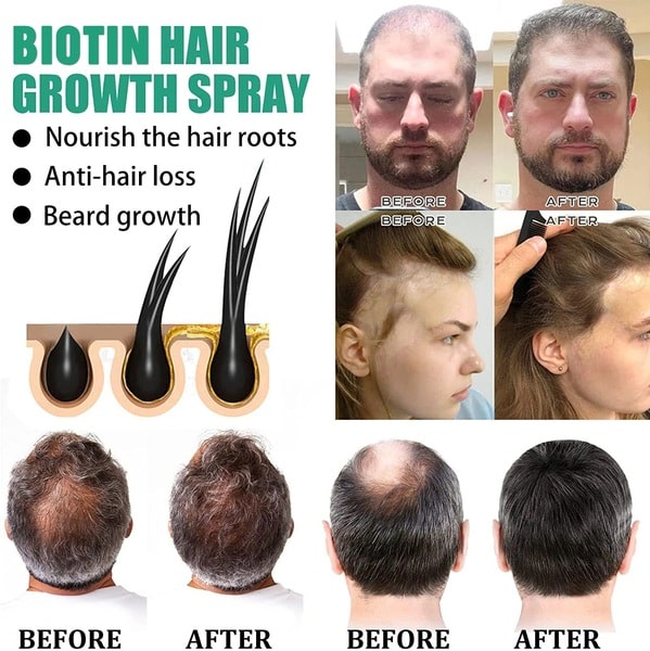 iBeaLee Hair Care Solution Strong Hair Nutrition Anti-falling Moisturizing Hair Root Thick Scalp Massage Nutrition - Image 6